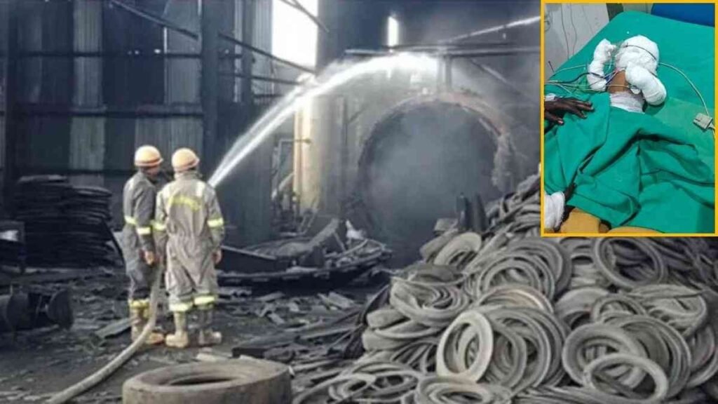 Raigarh Factory Blast : रायगढ़ फैक्ट्री ब्लास्ट में 9 माह की मासूम की मौत, कई मजदूर जिंदगी से जूझ रहे Raigarh Factory Blast